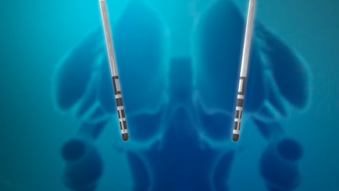 Icône éligibilité à la SCP